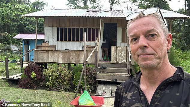 British travel agent Tony Exall was sampling holiday locations in Indonesia when he suffered a horrifying eye issue