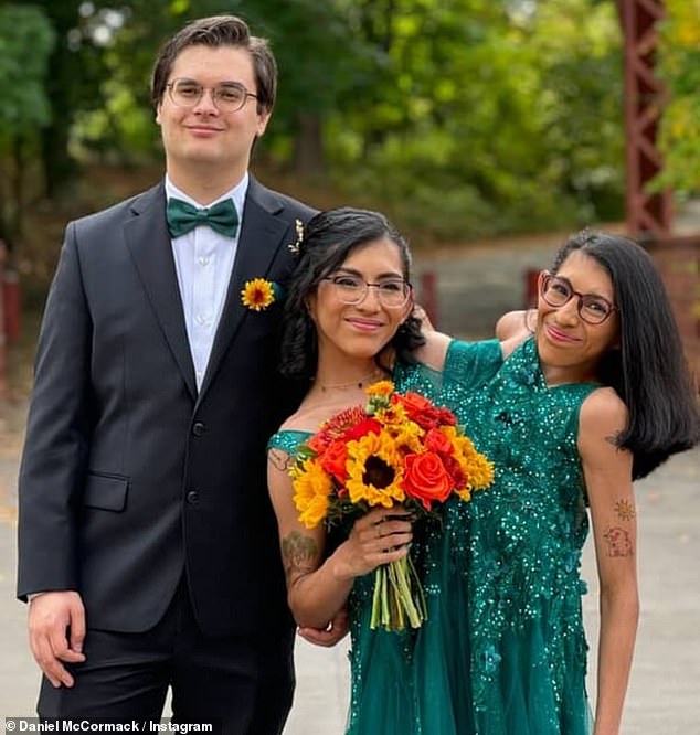 Conjoined twins Carmen and Lupita Andrade opened up about how they navigate boundaries- especially since Carmen tied the knot to Daniel McCormack